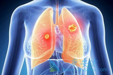 劳拉替尼 劳拉替尼