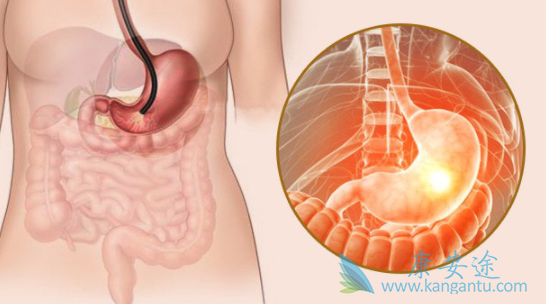 波齐替尼 波齐替尼