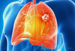 EGFR���Ƽ�����Ҫ��Ӧ֢�Ƿ�Сϸ���ΰ�