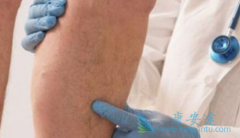 ����̹��������������Ƥ�ʰ����������ڸ��ֲ���Ŀ����ۺ���