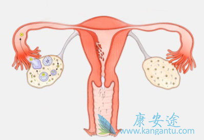 奥拉帕尼 奥拉帕尼