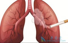 �����ΰ���ת��֢״����Ч�����Ʒ���