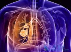 ����ҩ��������(dacomitinib)�ʺ����е�EGFRͻ��ΰ�������