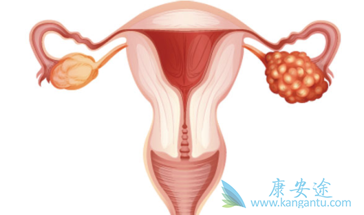 奥拉帕利 奥拉帕利