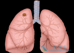 ���ڷ�Сϸ���ΰ�������EGFR-TKI�л�����