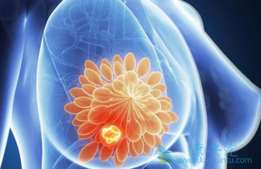 乳腺癌 乳腺癌
