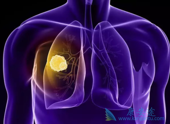 劳拉替尼 劳拉替尼