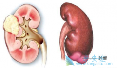 ������������ҩ�￨������ĸ�����������