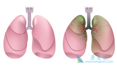 ΪʲôPD-1���Ƽ����ƺ��Сϸ���ΰ�ת��ΪСϸ���ΰ��ˣ�