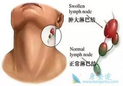 �ܰ������ܰͰ����ٴ�֢״��Σ�����кβ�ͬ��