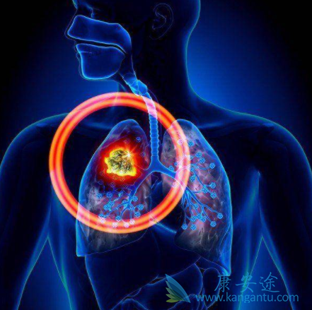 布加替尼 布加替尼