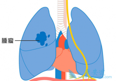 �����������������Щ����ͻ��ķ�Сϸ���ΰ���