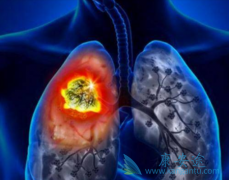 �ΰ���ҩ��������(lorlatinib)���ٴ�Ч���Ͱ�ȫ��