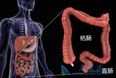 ���ڽ�ֱ������������������Ч��Ԥ����������Щ��