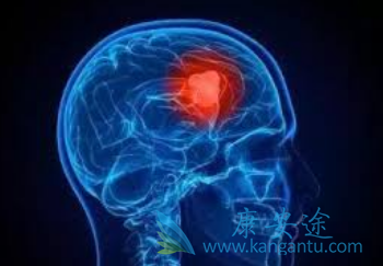 艾乐替尼 艾乐替尼