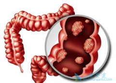 �󳦰�֢״֮һ��Ѫ���̴���Ѫ�кβ�ͬ��