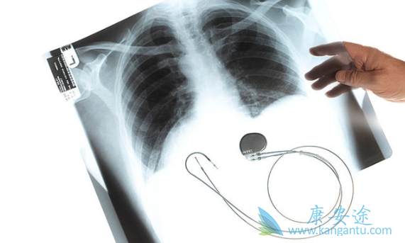 非小细胞肺癌 非小细胞肺癌