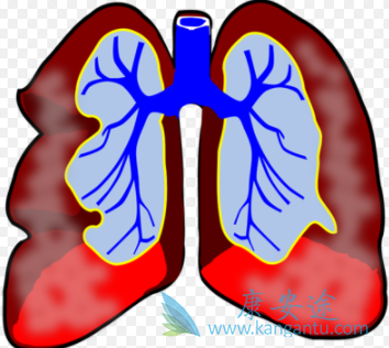 肺动脉高压 肺动脉高压