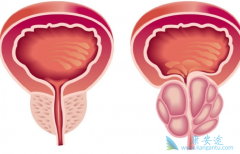 ��е����Ƽ���������(Cometriq)������ǰ���ٰ���