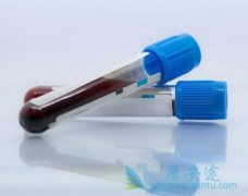 ��췢���Լ��ı��ο��������Ƿ���Ҫʹ��DAAҩ�����ƣ�