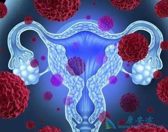 尼拉帕尼 尼拉帕尼