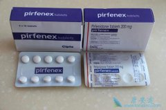 ����������ͪ(pirfenidone)�ļ��������������¼���Ԥ������