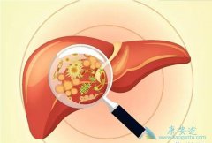 ���ڴ����Ҹο���Ϊʲô�����Ⱦ���ҸΣ�