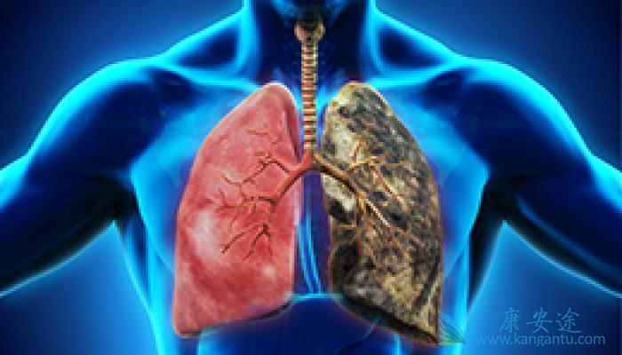 肺癌转移 肺癌转移