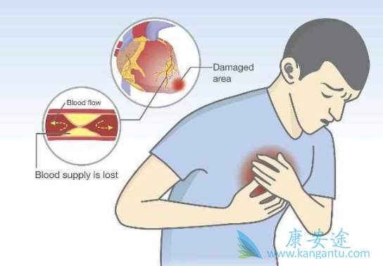 肺癌症状 肺癌症状