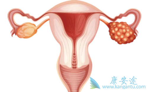 阿帕替尼 阿帕替尼