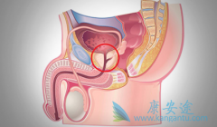 ���˶�����������ǰ���ٰ�֢��������ô���ƣ�