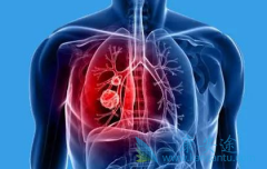 ROS1���ŷΰ���ҩ���������ֱ������һ�߷ΰ�������