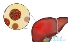 ���濨Τ��ҩ���߿ɸ�����ŵ��Τ