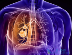 �ΰ�������������ЩСϸ���ΰ����ߣ�