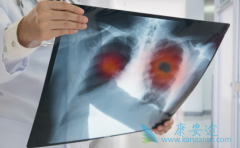 ��������(Brigatinib)�Ƿ�����ӳ�ȫ�Է���ʱ�䣿