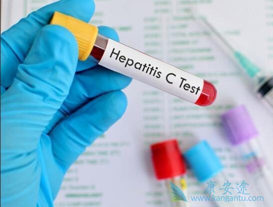 治疗丙肝的方法 治疗丙肝的方法