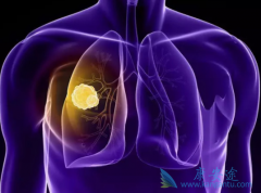 ����Ż���Ƿΰ���ת��֢״������