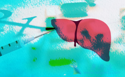 丙肝治疗 丙肝治疗