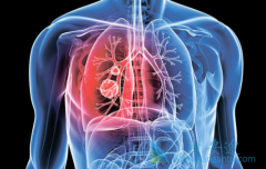 EGFR-TKI���Ϸΰ�������ʹ��Щ���ڷΰ����߻��棿