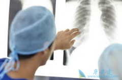 �ط��Է���ά��(IPF)���ǰ�֢��Σ������ȴʤ�ư�֢