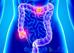 �����鵥��/̩����һ�����ƽ�ֱ������Ч�߸�����С