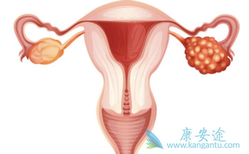 阿帕替尼 阿帕替尼