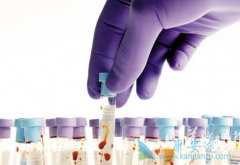 ���Ա����ٴ�֢״����Щ�����Ա��ο���������