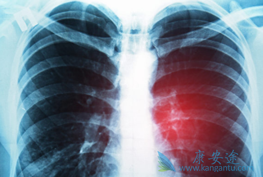 培美曲塞 培美曲塞