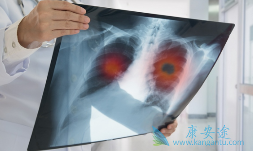 非小细胞肺癌 非小细胞肺癌