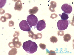 ������ϸ���ܰ�����ҩ������Щ����³����Ч����ô����