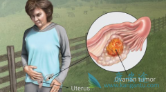 Ŀǰ�й��ѳ�����������Ҫʹ����Щҩ�