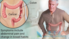 ��ֱ�����е�����������������ʲô��˼��