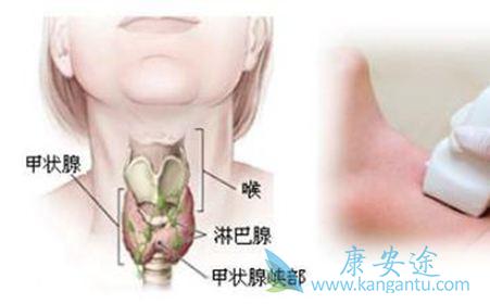 甲状腺肿瘤 甲状腺肿瘤