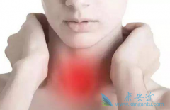 RETԭ������ͻ��ļ�״�������ÿ�������(cabozantinib)��